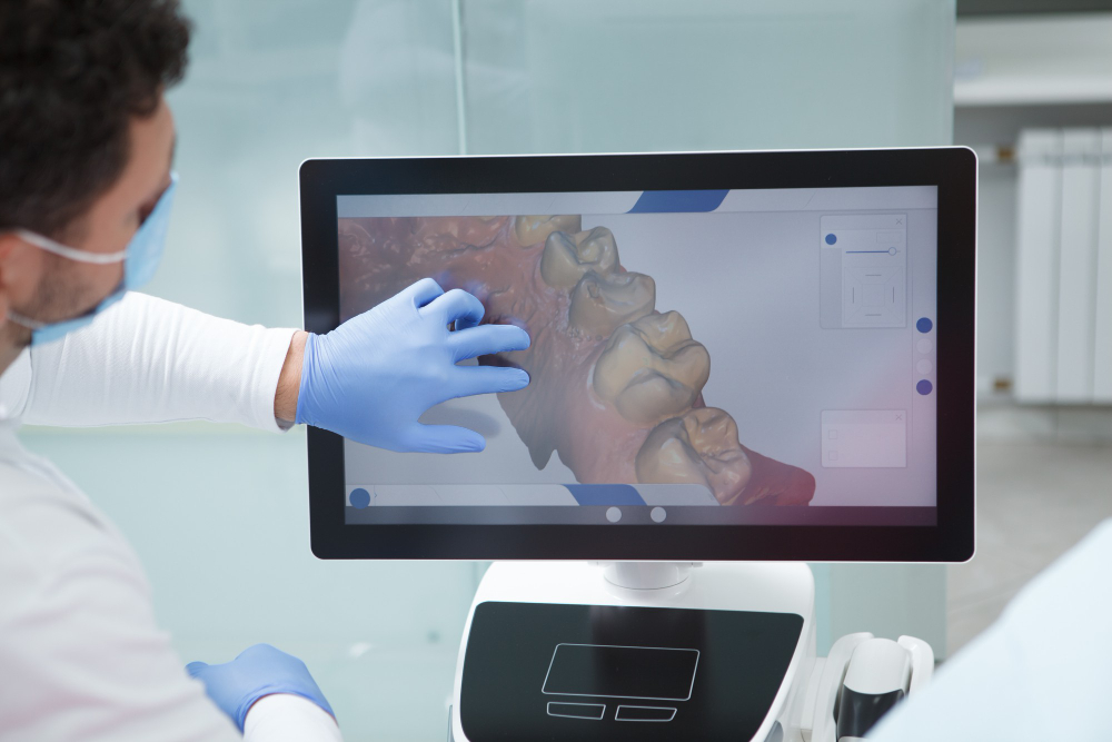scanner 3d itero